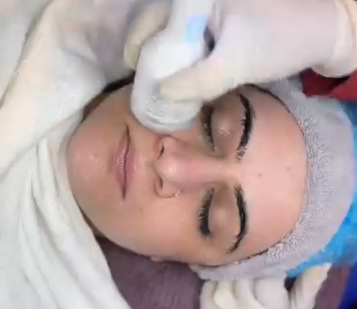 Hydrafacial