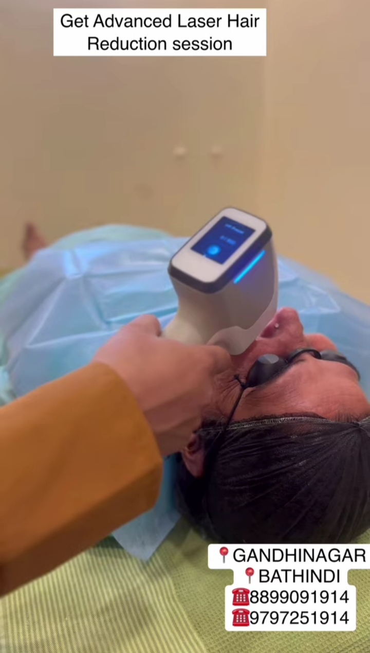 Laser Hair Removal